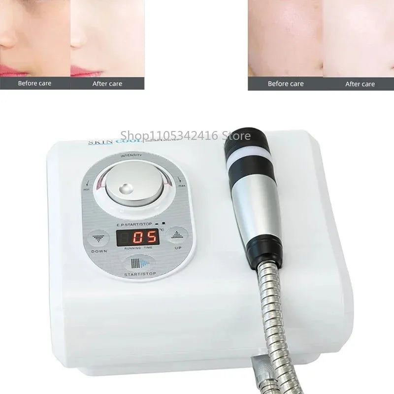 Portable RF Beauty Device — main product photo