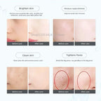 Portable RF Beauty Device — product photo 4 of 6