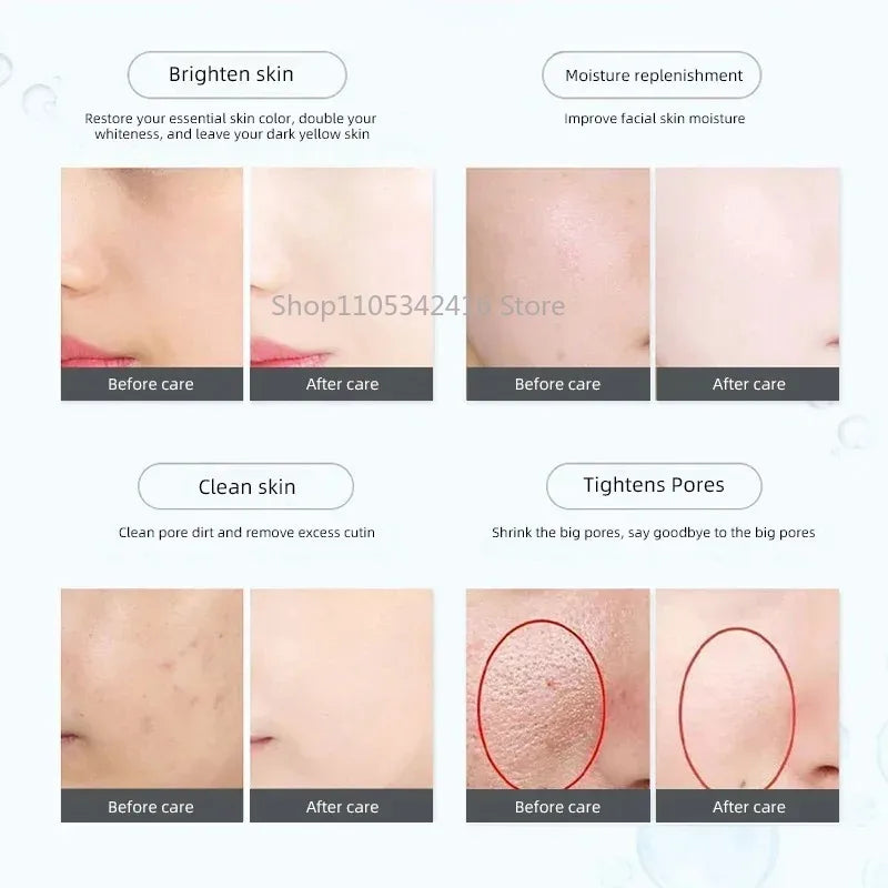 Portable RF Beauty Device — product photo 4 of 6