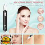 Midjustty Skin Tag Remover White — product photo 2 of 5