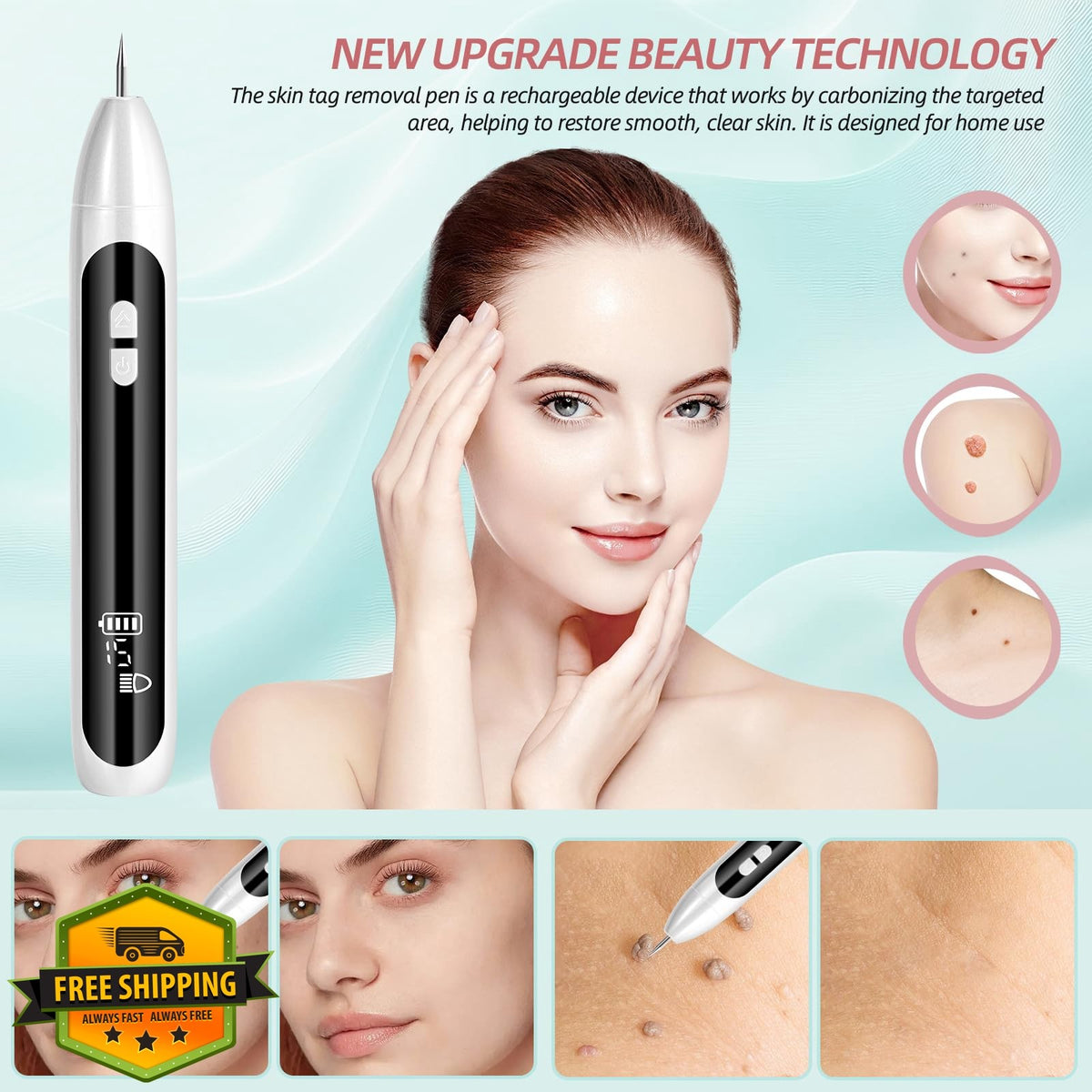 Midjustty Skin Tag Remover White — product photo 2 of 5