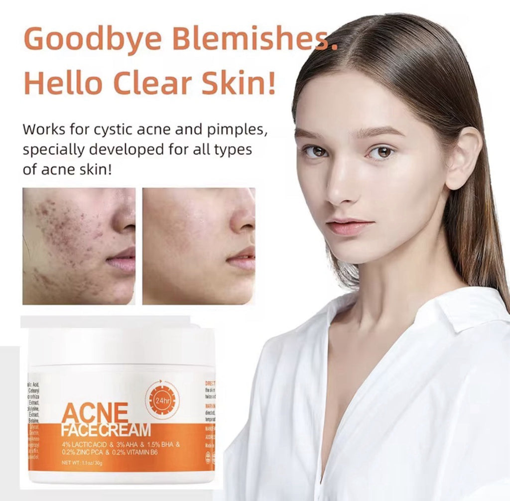 Acne Face Cream with Lactic Acid — main product photo