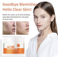 Acne Face Cream with Lactic Acid — main product photo