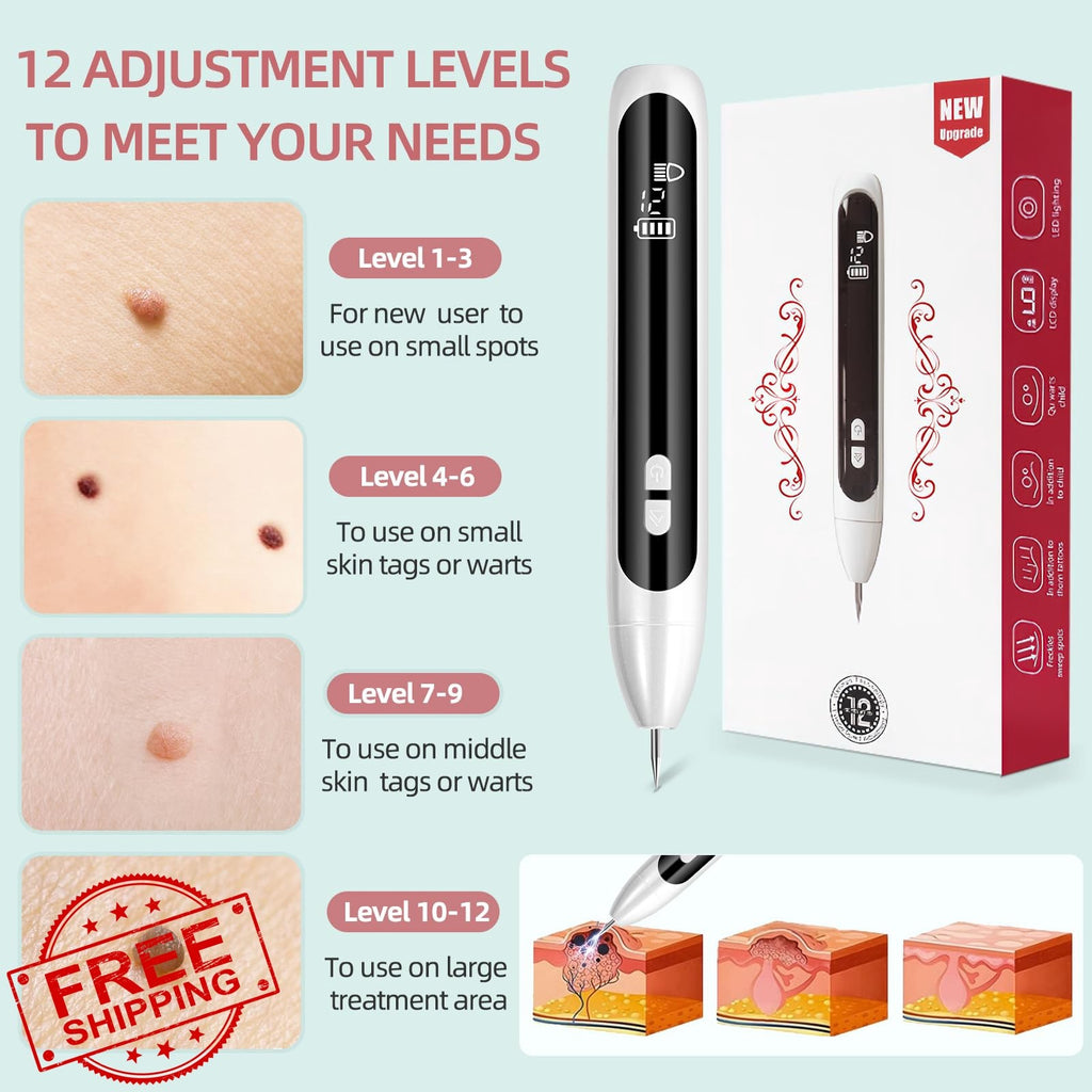 Midjustty Skin Tag Remover White — product photo 4 of 5