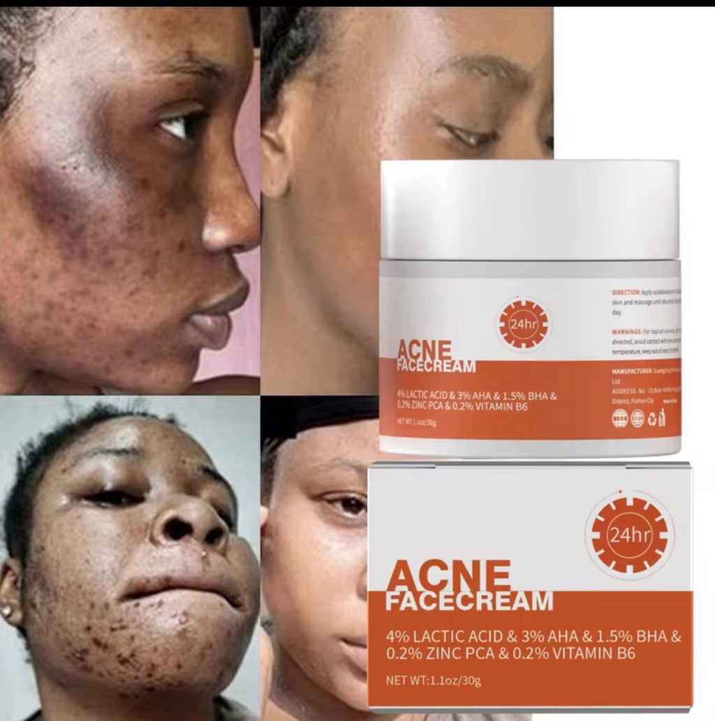 Acne Face Cream with Lactic Acid — product photo 2 of 9