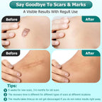 Scar Gel — product photo 2 of 4