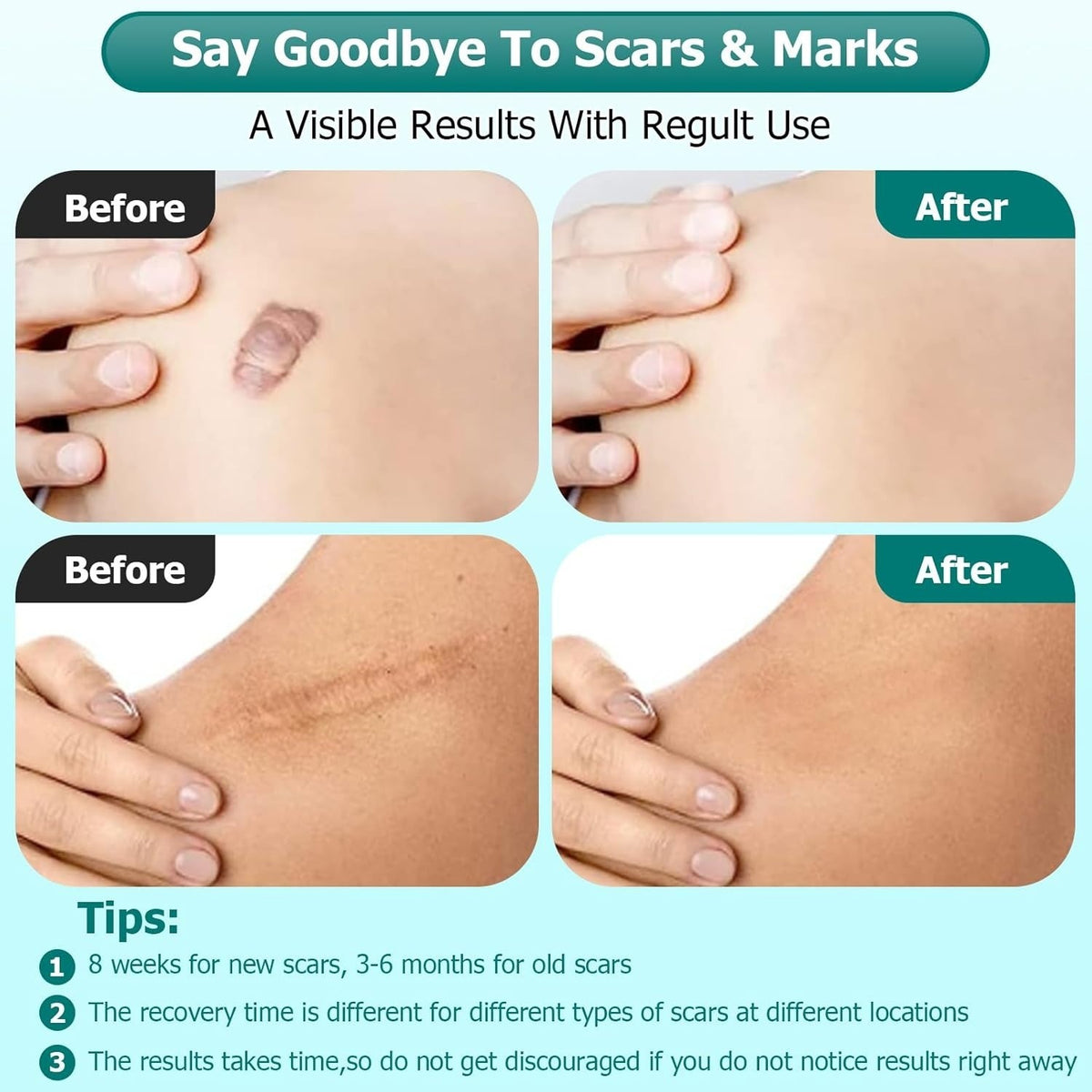 Scar Gel — product photo 2 of 4