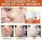 Acne Face Cream with Lactic Acid — product photo 7 of 9