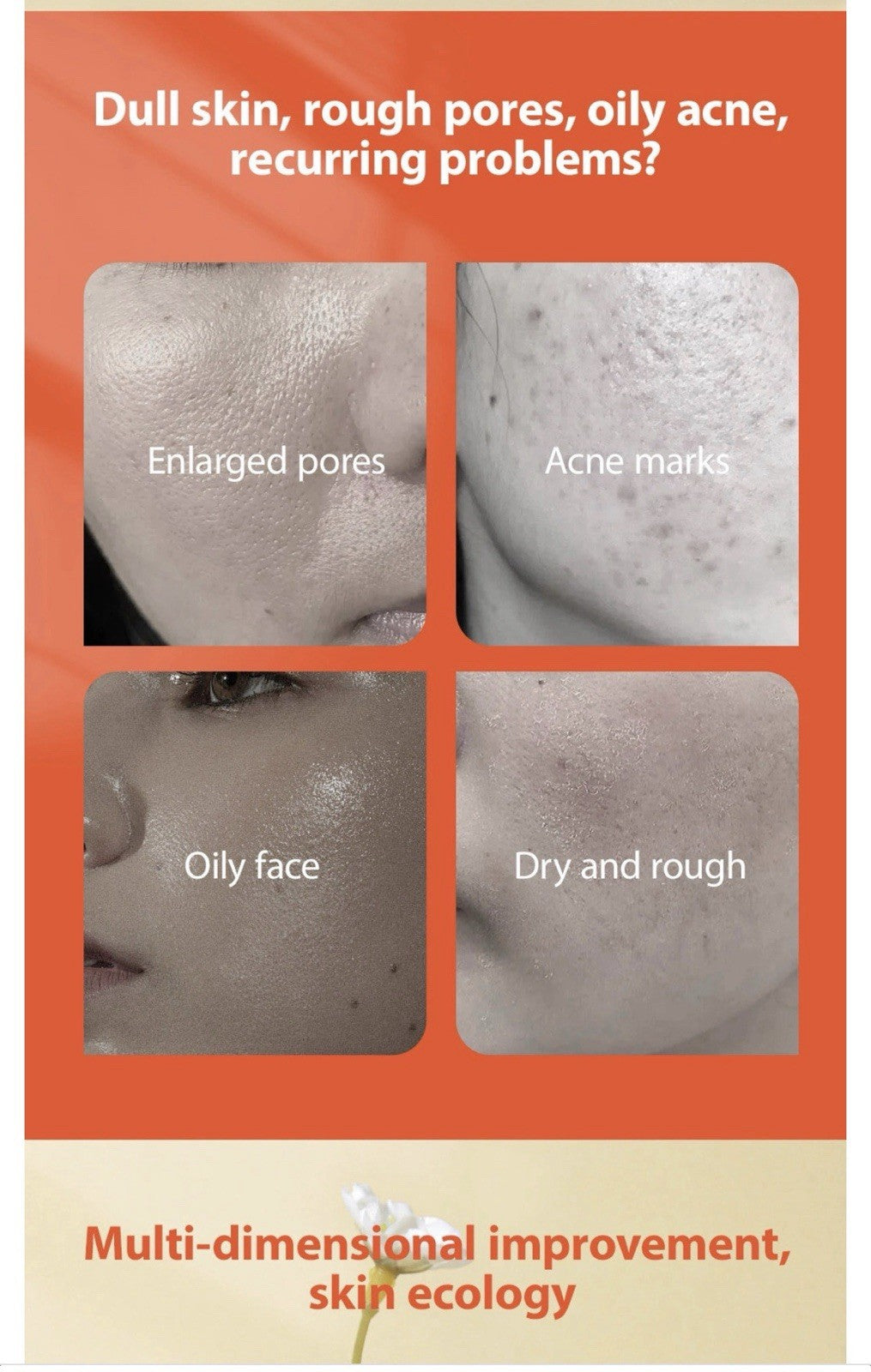 Acne Face Cream with Lactic Acid — product photo 3 of 9